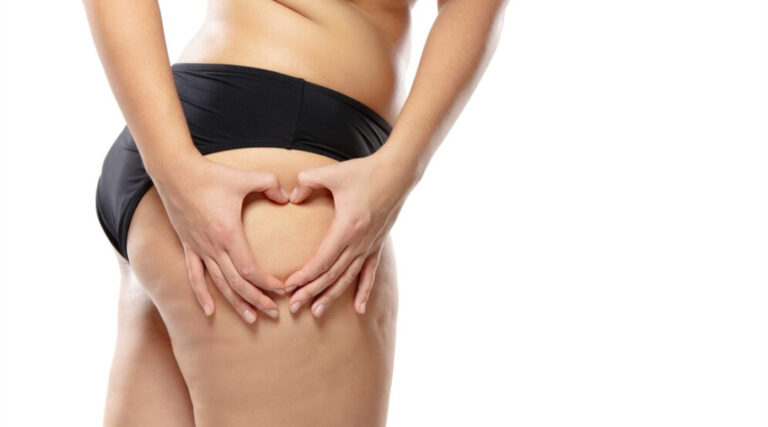 Causes of cellulite and best non-surgical treatments like Emtone, Emsculpt, and lymphatic drainage at Body Lounge Weston.