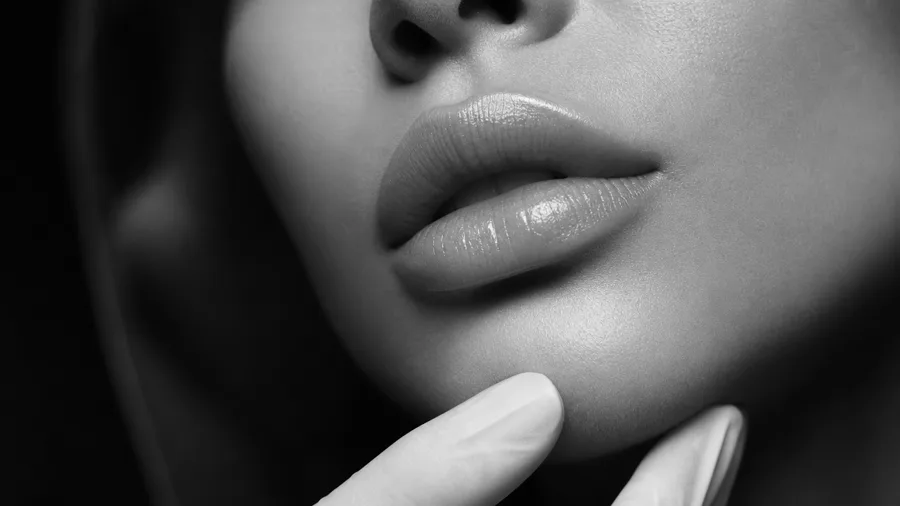 Dermal filler treatment at Body Lounge Med Spa