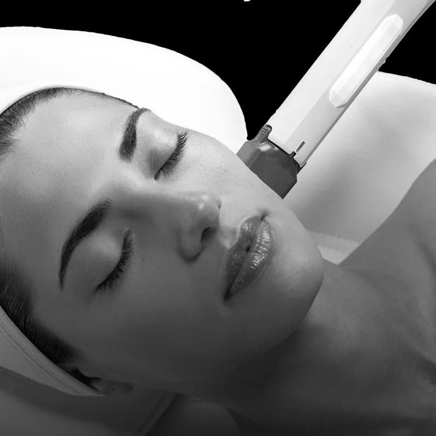 XERF skin tightening on the face and neck at Body Lounge Med Spa